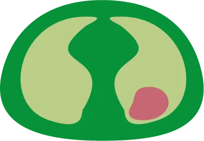 アノテーション